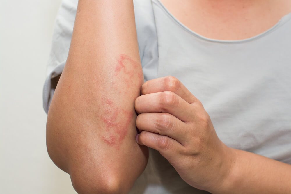 Skin Disease