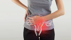 Menstrual Problems